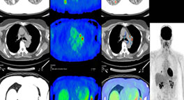 CT, MRI, PET